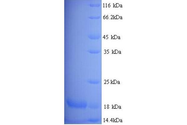 Major Urinary Protein 19 (MUP19) (AA 1-151), (full length) Protéine