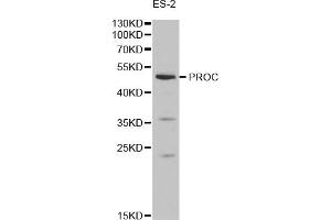 Western blot analysis of extracts of ES-2 cells, using PROC antibody (ABIN1874338) at 1:1000 dilution. (PROC anticorps)