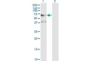 Western Blot analysis of PLK1 expression in transfected 293T cell line by PLK1 monoclonal antibody (M01), clone 2G12.