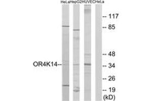 Western blot analysis of extracts from HeLa/HepG2/HuvEc cells, using OR4K14 Antibody. (OR4K14 anticorps  (AA 261-310))