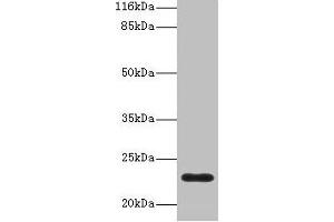 Western blot All lanes: C8G antibody at 2 μg/mL + Human serum Secondary Goat polyclonal to rabbit IgG at 1/10000 dilution Predicted band size: 23 kDa Observed band size: 23 kDa (C8G anticorps  (AA 21-202))