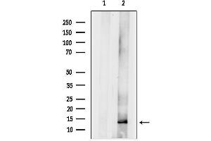 anti-Ribosomal Protein, Large, p1 (RPLP1) (Internal Region) antibody