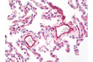 Anti-MCAM / CD146 antibody IHC staining of human lung. (MCAM anticorps  (AA 84-189))