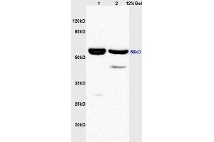 Lane 1: rat liver lysates Lane 2: rat brain lysates probed with Anti phospho-AKT1/2/3 (Tyr315/316/312) Polyclonal Antibody, Unconjugated (ABIN756217) at 1:200 in 4 °C. (AKT 1/2/3 anticorps  (pTyr312, pTyr315, pTyr316))