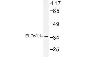 Image no. 1 for anti-ELOVL Fatty Acid Elongase 1 (ELOVL1) antibody (ABIN317834) (ELOVL1 anticorps)