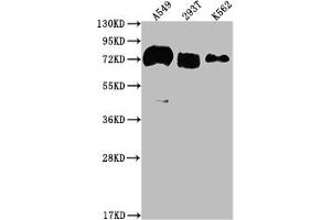 Western Blot Positive WB detected in: A549 whole cell lysate, 293T whole cell lysate, K562 whole cell lysate All lanes: CD55 antibody at 1:2000 Secondary Goat polyclonal to rabbit IgG at 1/50000 dilution Predicted band size: 42, 49, 40, 57, 60 kDa Observed band size: 70 kDa (Recombinant CD55 anticorps)