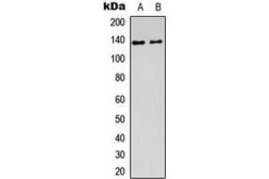 Western blot analysis of DDX8 expression in Jurkat (A), Y79 (B) whole cell lysates.