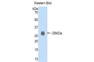 Western Blotting (WB) image for anti-Lysyl Oxidase-Like 2 (LOXL2) (AA 544-751) antibody (ABIN1859686) (LOXL2 anticorps  (AA 544-751))