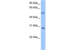 Western Blotting (WB) image for anti-Retinoic Acid Induced 12 (RAI12) antibody (ABIN2463621) (Retinoic Acid Induced 12 (RAI12) anticorps)