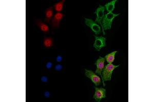 ABIN7094773 and ABIN7098824 staining HepG2 cells by IF/ICC.