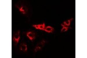 Immunofluorescent analysis of VPS37A staining in A549 cells. (VPS37A anticorps)