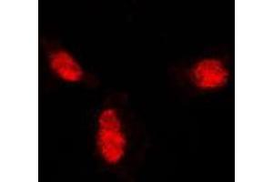 Immunofluorescent analysis of SUMO1 staining in A431 cells. (SUMO1 anticorps  (N-Term))