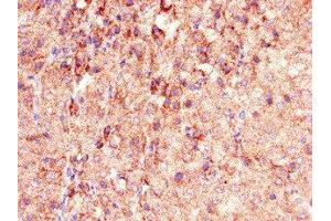 Immunohistochemistry of paraffin-embedded human adrenal gland tissue using ABIN7163679 at dilution of 1:100 (PHLDB2 anticorps  (AA 734-1030))