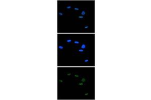 Immunofluorescence Microscopy of anti-Ash2 antibody Immunofluorescence Microscopy results of Rabbit anti-Ash2 antibody.