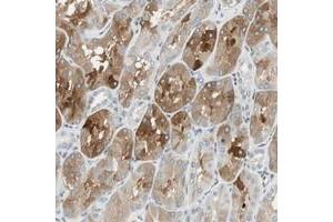 Immunohistochemical staining of human kidney with C14orf101 polyclonal antibody  shows cytoplasmic positivity in cells of renal tubules at 1:50-1:200 dilution. (C14orf101 anticorps)