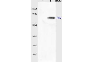 Lane 1: mouse lung lysates Lane 2: mouse brain lysates probed with Rabbit Anti-MASP2 Polyclonal Antibody, Unconjugated (ABIN676223) at 1:200 in 4 °C. (MASP2 anticorps  (AA 351-450))