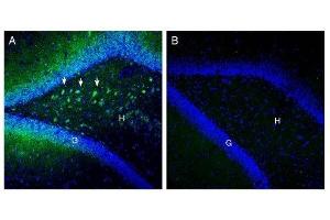 Expression of SLC25A12 in rat hippocampus. (SLC25A12 anticorps  (Intracellular, N-Term))