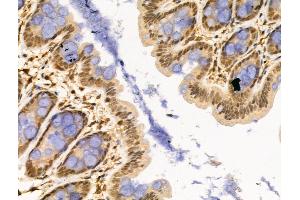 ABIN6257553 and ABIN6274359 at 1/100 staining Rat stomach tissue by IHC-P.