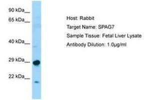 Image no. 1 for anti-Sperm Associated Antigen 7 (SPAG7) (N-Term) antibody (ABIN6750073) (SPAG7 anticorps  (N-Term))