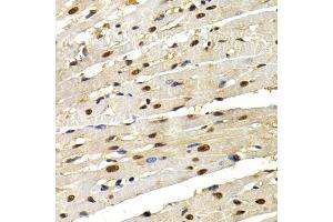 Immunohistochemistry of paraffin-embedded rat heart using IRF2 antibody (ABIN3023366, ABIN3023367, ABIN3023368 and ABIN6219659) at dilution of 1:200 (40x lens).