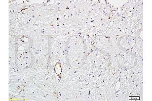 Formalin-fixed and paraffin embedded rat brain tissue (ABIN670506) at 1:300 followed by conjugation to the secondary antibody and DAB staining. (VWF anticorps  (AA 701-800))