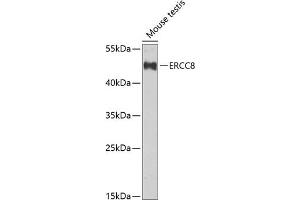 Western blot analysis of extracts of mouse testis, using ERCC8 Antibody (ABIN6134311, ABIN6140278, ABIN6140280 and ABIN6222611) at 1:1000 dilution.
