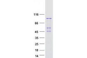 Validation with Western Blot