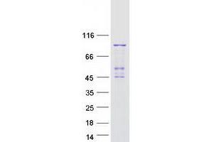 Validation with Western Blot (PLA2G6 Protein (Transcript Variant 1) (Myc-DYKDDDDK Tag))
