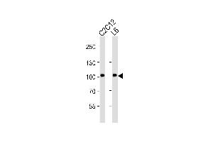 Western blot analysis of lysates from C2C12, L6 cell line (from left to right), using Musk Antibody (ABIN6242455 and ABIN6577083). (MUSK anticorps  (AA 600-860))