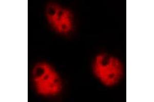 ABIN6268828 staining Hela by IF/ICC. (DDIT3 anticorps  (Internal Region))