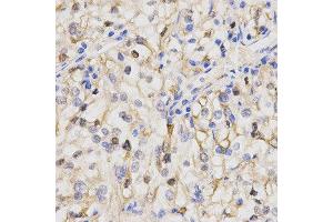 Immunohistochemistry (IHC) image for anti-Protein Phosphatase 2A Activator, Regulatory Subunit 4 (PPP2R4) (AA 1-323) antibody (ABIN6219052) (PPP2R4 anticorps  (AA 1-323))