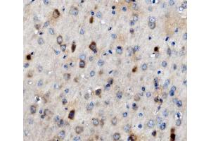 IHC analysis of MAP3K8 using anti-MAP3K8 antibody (ABIN4886663). (MAP3K8 anticorps  (AA 9-193))