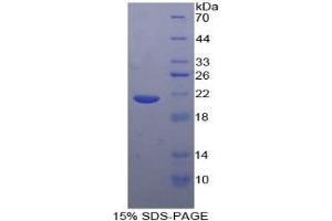SDS-PAGE of Protein Standard from the Kit (Highly purified E. (TNF alpha Kit ELISA)