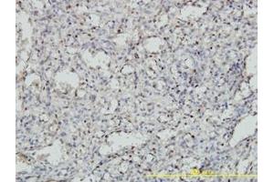 Image no. 1 for anti-Meis Homeobox 2 (MEIS2) (AA 1-382) antibody (ABIN598810) (MEIS2 anticorps  (AA 1-382))