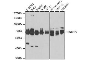 Western blot analysis of extracts of various cell lines, using HNRNPL antibody. (HNRNPL anticorps)