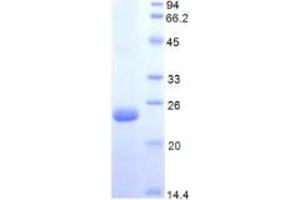 SDS-PAGE of Protein Standard from the Kit  (Highly purified E.