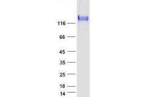 Validation with Western Blot