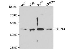 Western blot analysis of extracts of various cell lines, using SEPT4 antibody (ABIN4905117) at 1:1000 dilution. (Septin 4 anticorps)