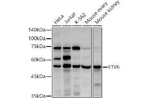 Western blot analysis of extracts of various cell lines, using ETV6 antibody (ABIN3022302, ABIN3022303, ABIN3022304, ABIN1512878 and ABIN6218719) at 1:1000 dilution. (ETV6 anticorps  (AA 1-300))