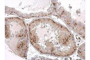 IHC-P Image Androgen Receptor antibody [N1], N-term detects Androgen Receptor protein at nucleus on mouse prostate by immunohistochemical analysis. (Androgen Receptor anticorps  (N-Term))
