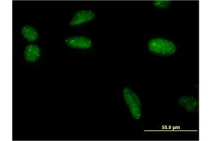 Immunofluorescence of monoclonal antibody to SUMO1 on HeLa cell. (SUMO1 anticorps  (AA 1-101))