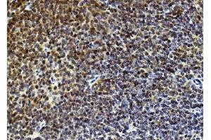 IHC analysis of Rad9/Rad9a using anti-Rad9/Rad9a antibody (ABIN7599342). (RAD9A anticorps  (AA 1-389))