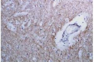 Immunohistochemistry (IHC) image for anti-Syntaxin 1A (Brain) (STX1A) antibody (ABIN492371)