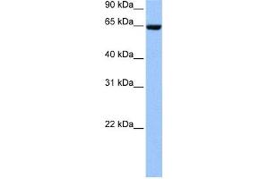 WB Suggested Anti-COL4A3BP Antibody Titration: 0. (COL4A3BP anticorps  (N-Term))