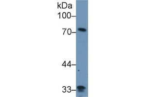 Western Blot; Sample: Human Lung lysate; Primary Ab: 1µg/ml Rabbit Anti-Human ZYX Antibody Second Ab: 0.