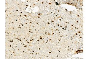 ABIN6260618 and ABIN6276638 at 1/100 staining Rat brain tissue by IHC-P. (CD3D anticorps  (Internal Region))