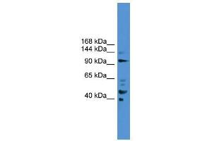 PIBF1 antibody used at 0. (PIBF1 anticorps  (C-Term))