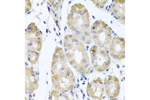 Immunohistochemistry of paraffin-embedded human stomach using CBR4 antibody. (CBR4 anticorps)