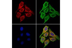 ABIN6258195 and ABIN6276040 staining Hela cells by IF/ICC. (GPR87 anticorps  (Internal Region))