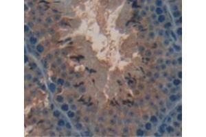 IHC-P analysis of Mouse Tissue, with DAB staining. (COMP anticorps  (AA 40-180))